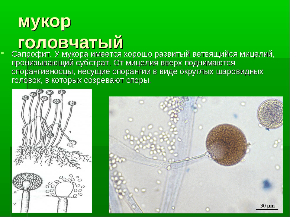 Представители мукора. Строение плесневого гриба мукора. Мицелий мукора. Строение клетки мукора. Мукор гриб паразит.