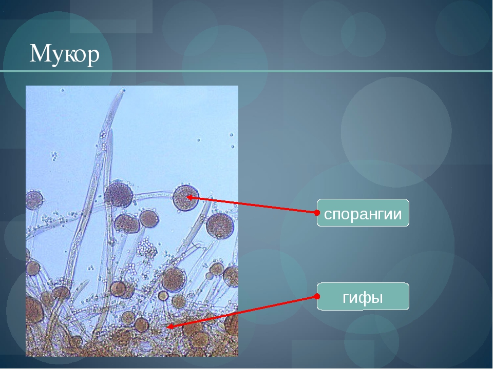Споры гриба мукора. Клетка гриба мукора. Мукор в микроскопе. Строение спорангия мукора.