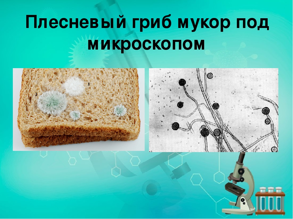 Плесневые грибы на хлебе. Микропрепарат плесневого гриба мукора под микроскопом. Рассмотрите микропрепарат плесени гриба мукора. Строение плесени под микроскопом. Клетка плесени мукора под микроскопом.