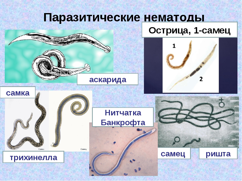 Круглыми червями являются. Паразитические круглые черви нитчатка Банкрофта. Нематоды - Первичнополостные черви. Нитчатый червь Острица. Nematoda (круглые черви).