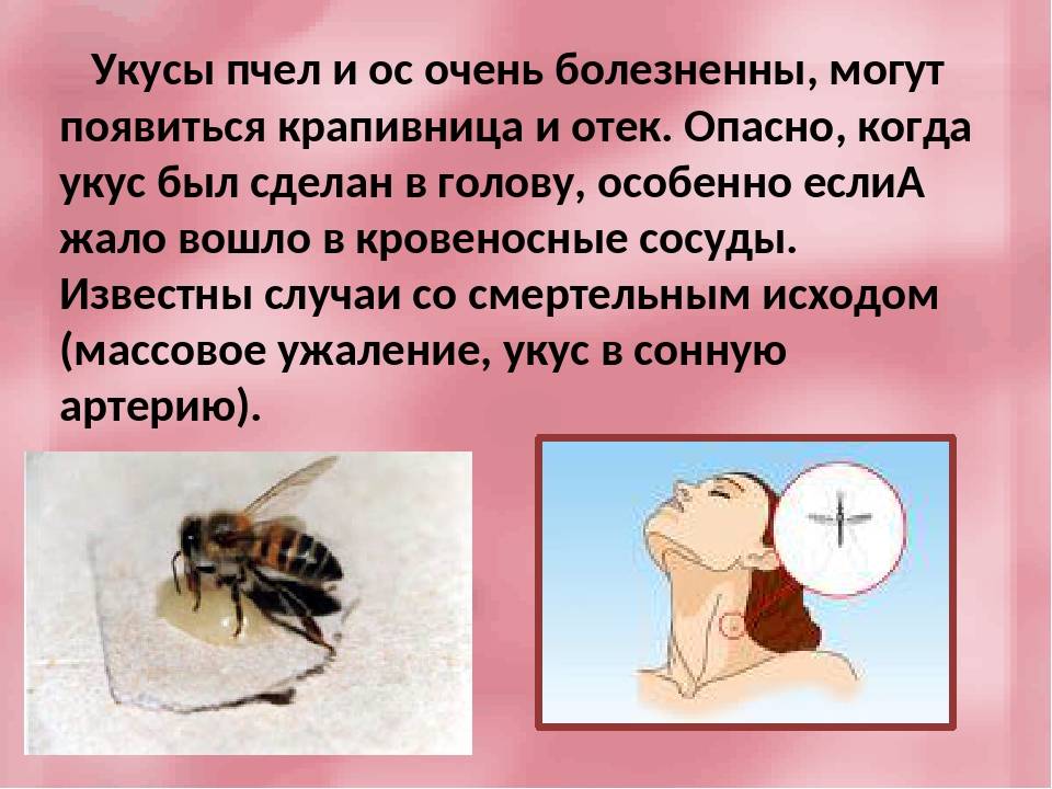 Укусы ос что делать. Первая помощь при укусе пчел и осы. Что делать при укусе пчелы. Первая помощь при укусе пчелы. Ужалила Оса первая помощь.